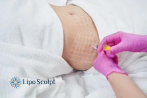 Are The Results From Aqualyx Permanent? 1 Do you want to know how long Aqualyx Cambridgeshire results last?