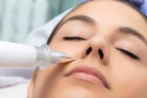 Best Actinic Keratoses Removal 3 Actinic keratoses Cambridgeshire solutions - book in today!
