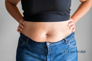 Bidding Farewell to Muffin Tops with Aqualyx Fat Injections 2 Do you wish you could reduce your muffin top Cambridgeshire With Aqualy fat dissolving injections you can!